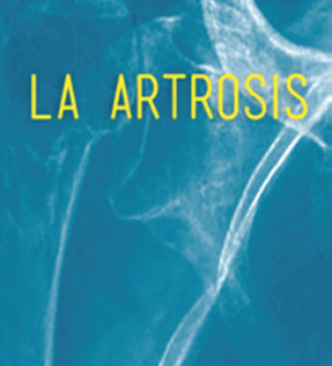 La Artrosis